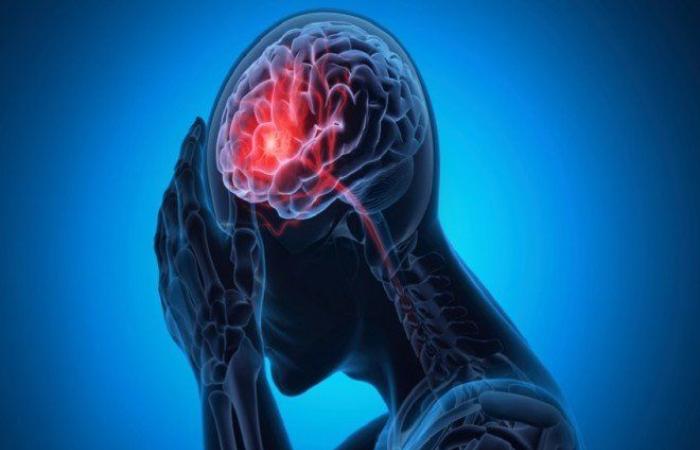 دراسة حديثة تكشف العلاقة بين صحة الفم والصداع النصفي